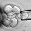 Stem